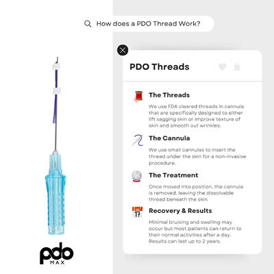"What Are PDO Threads Roseville"