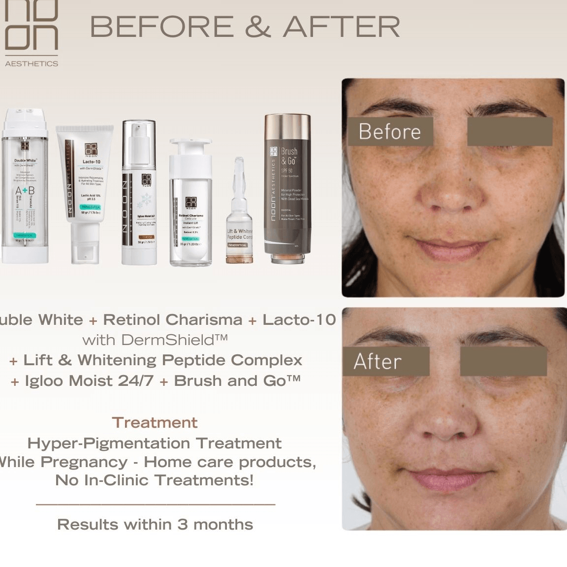 Noon Aesthetics Before & After